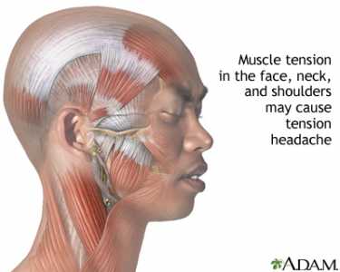 Temporal Sphenoid