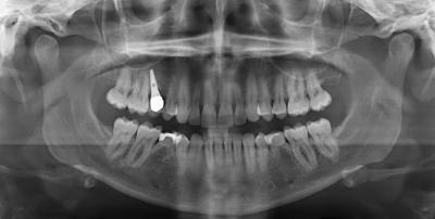 xray