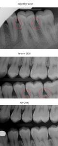 xray 2018 2020