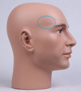 temporalis