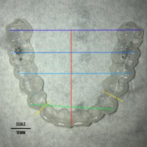 maxillary arch