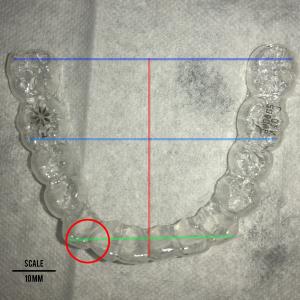 mandibular arch
