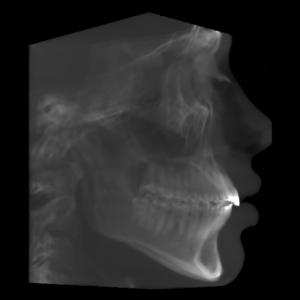 VirtualCeph CBCT