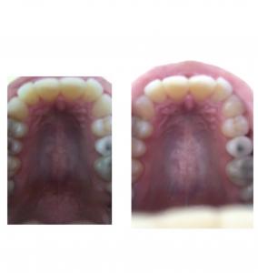03ECC43A 18CD 4CB1 BFAB 878B246A433A