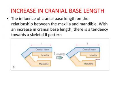 cranial base angle in relation to malocclusion 24 638