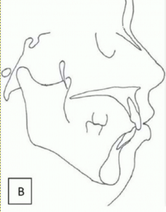biobloc