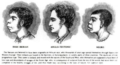 Scientific racism irish
