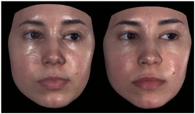 homeoblock facial changes