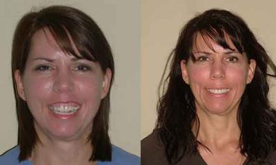 cosmetic before after1