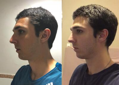 20 Dec 2018 vs 13 May 2019 (4.7 months)