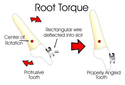 Root Torque