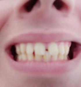 IMG 20200331 154908 1o