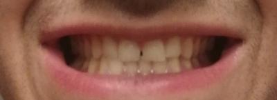 mouth 2