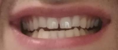mouth 1