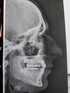 x ray 13 3 2021