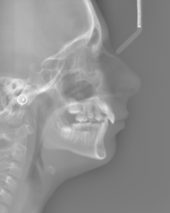 x ray 2012