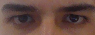 eyesupport