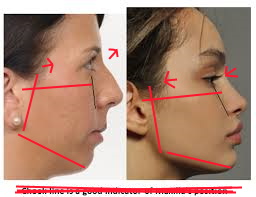 picture1