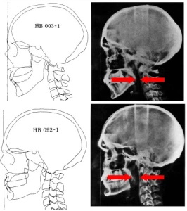 airwaysosa