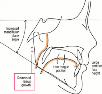 figure fig1