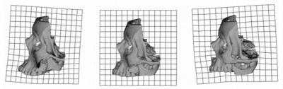 maxilla