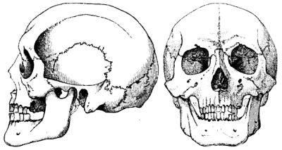 Mongoloid skull Huxley
