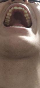 palate