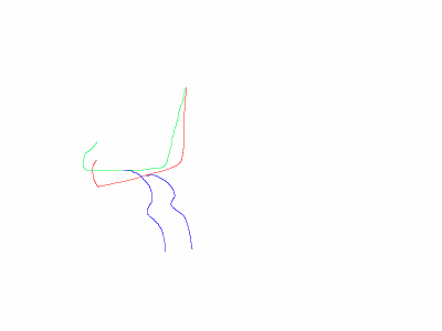 neck2