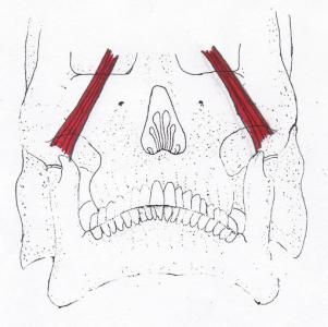 sphenomandibularis 3