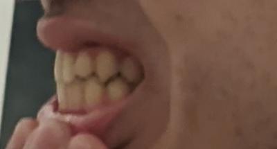 pic2