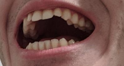pic3