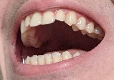 pic1