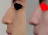 closeup2