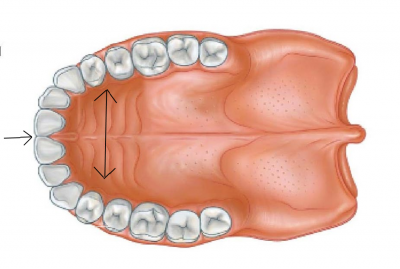 palate