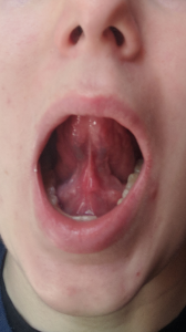 tongue