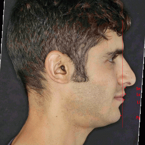44+Weeks+Side+Profile copy