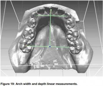 Australian Aboriginal Dental Dimensions