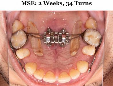MSE wk 2