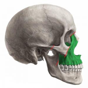 circummaxillary sutures