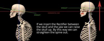 Rectifier