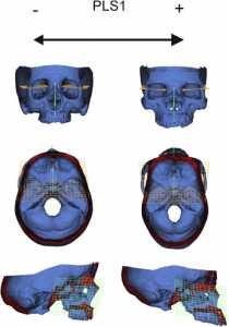 Cranial Base