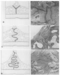 midpalatal suture interdigitation stages
