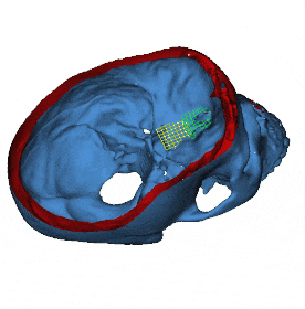 Cranial Base (s)