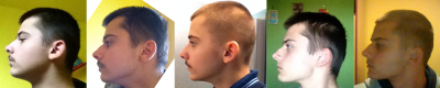 5 month progress