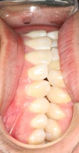 IMG 0079