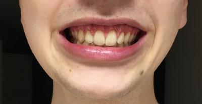 IMG 1754