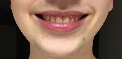IMG 1753