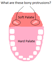 bony protrusions