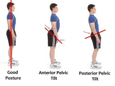 ant pelvic tilt