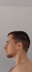 e5ppll81kg881
